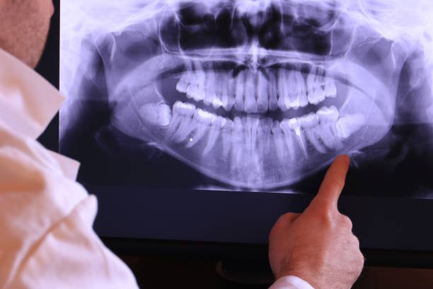 Best Emergency Dental Care for Broken or Chipped Teeth in Kings Park, NY